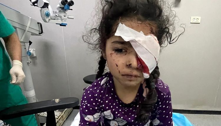  Ribuan Warga Gaza Kehilangan Penglihatan Akibat Perang Genosida