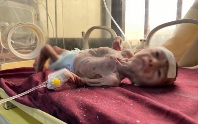  100.000 Bayi di Gaza Terancam Meninggal Akibat Blokade Israel