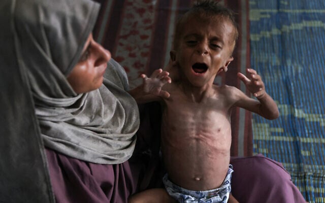 Warga Gaza yang Meninggal Kelaparan 313 Orang, Termasuk 119 Anak-anak